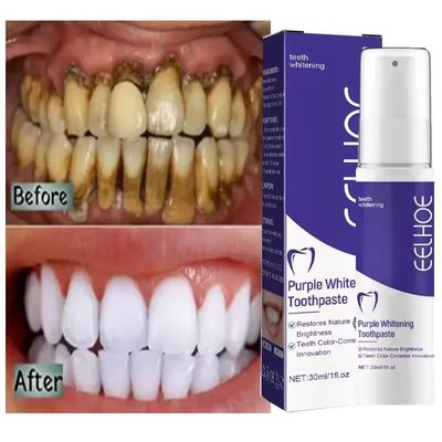 Teeth Whitening Toothpaste Serum Remove Plaque Sta Oral Hygi