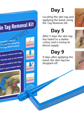Blue Set Skin Tag Removal Kit Home Use Mole Wart Remover Equ