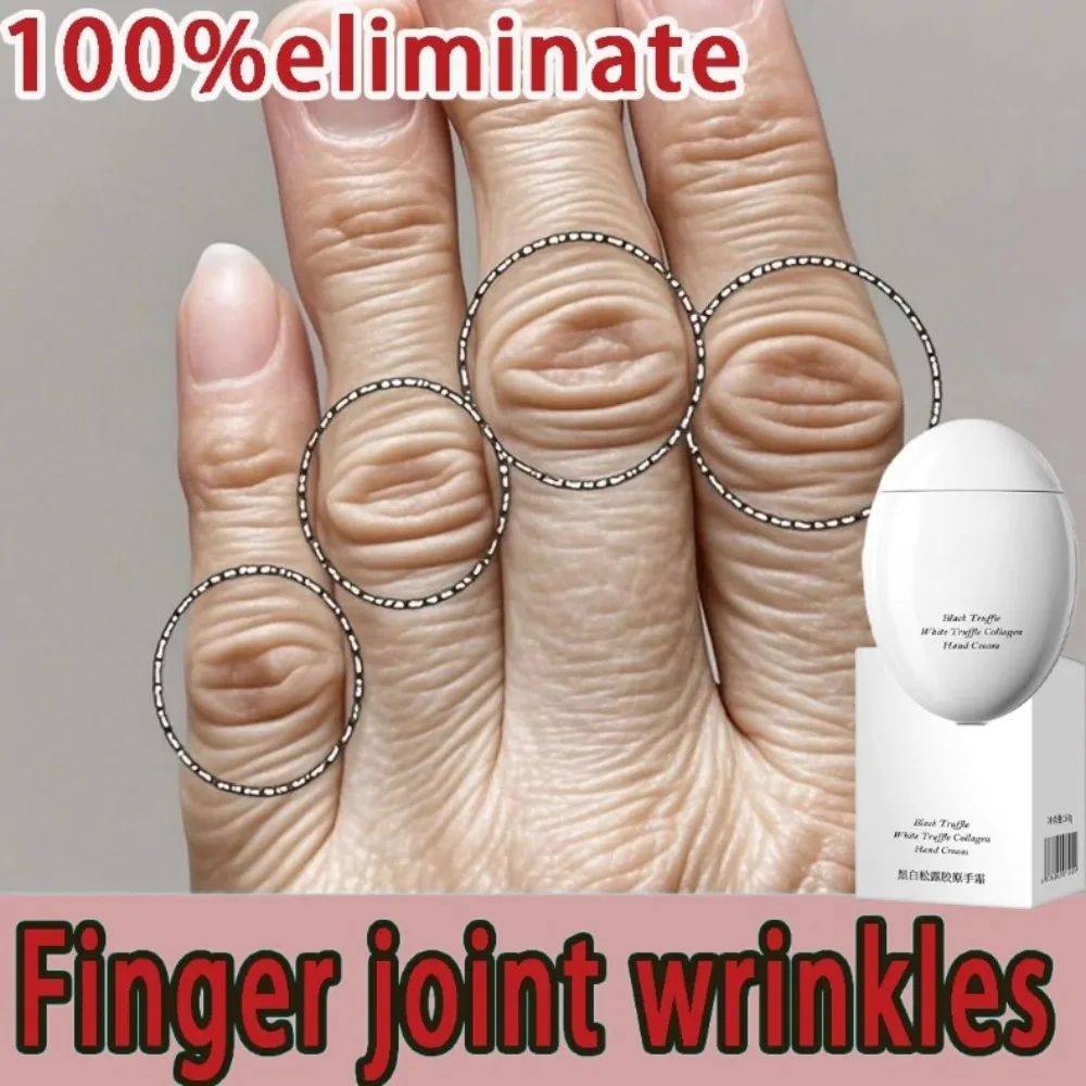 Hand cream for removing wrinkles on finger joints, removing