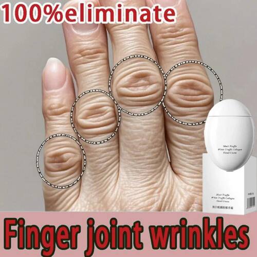 Hand cream for removing wrinkles on finger joints, removing