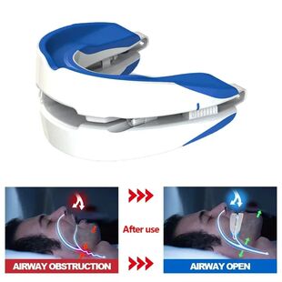 Anti-Snoring Mouthpiece Anti-Snoring Device Night Time Teeth