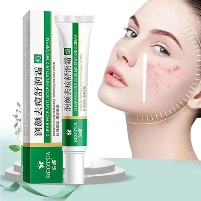 Herbal Acne Treatment Cream Face Scar Blackhead Remover Repa