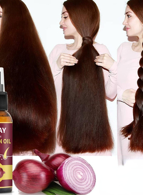 Hair Grouth Fast Onion Black Seed Essential Oils Oil Spray f