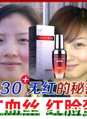 高原红精华液去红血丝舒缓正品面部淡化修复角质层红脸蛋过敏褪红