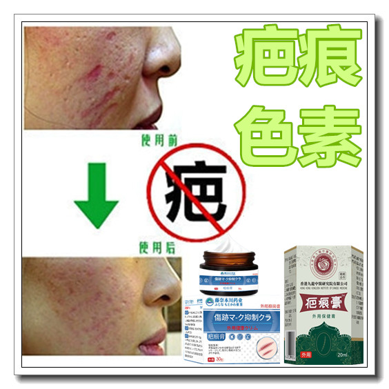 祛除黑色素印沉淀修复贴膏手术伤痕淡化男女色素沉着回流黑印药霜