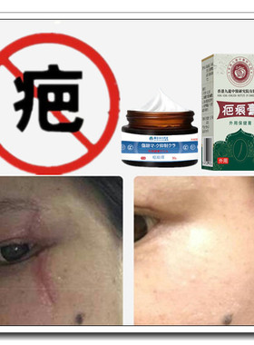 去烟疤缝针手术修复霜消除冻疮凸疤增生性疙瘩祛开刀色素巴痕灵药