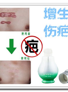 去刨妇产老疤祛除脸部黑色素痕美疤痕硅凝胶芦荟胶修复产品药膏贴