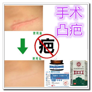增生疙瘩修复液去凸疤祛除手术破腹产伤疤痕印灵缝针色素沉淀药膏