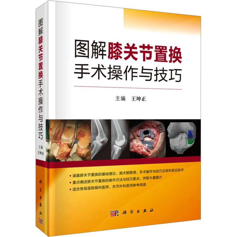 图解膝关节置换手术操作与技巧 王坤正 膝关节置换基础理论围术期管理手术操作技巧 骨科医师关节外科医师临床骨科手术图谱书籍