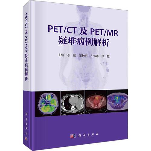 PET/CT及PET/MR疑难病例解析 李彪等疑难病影像诊断病案分析非肿瘤性病变疑难病例18F-FDG显像剂新型PET分子探针