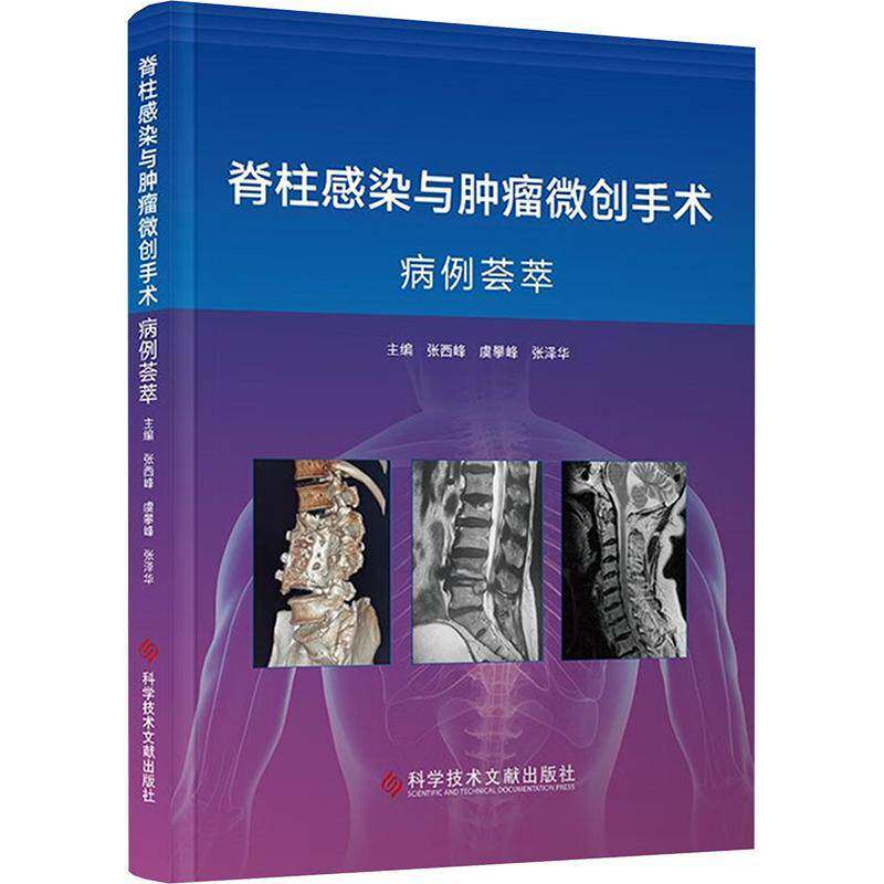 脊柱感染与肿瘤微创手术病例荟萃 张西峰 虞攀峰 张泽华 脊柱结核微创手术 9787523522974 科学技术文献出版社