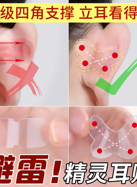蝴蝶精灵耳贴强支撑隐形不痛女生固定招风耳矫正器立耳定型神器