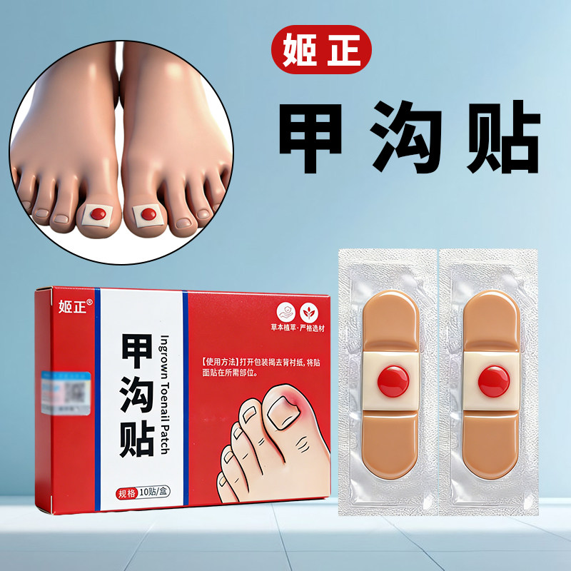 姬正甲沟贴矫正器正甲贴嵌甲脚指甲纠正器防趾甲长肉里专用隔离贴