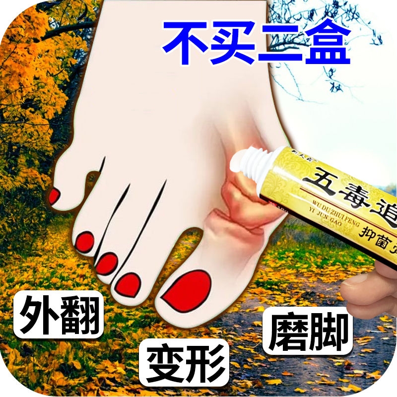 五毒追风膏拇指外翻膏大拇指疼痛大脚骨脚趾关节畸形矫正器拇囊炎