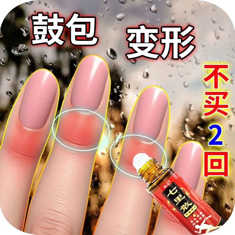 七里散手指滚珠疼痛用弯曲骨刺变形肿大僵硬类劳损骨性