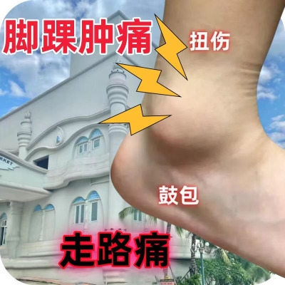 脚踝扭伤脚关节鼓包肿胀疼痛脚腕肿痛积液脚脖子走路疼专用喷剂