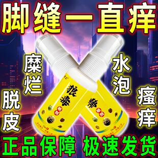 王喷雾脱皮真菌感染用臭脚痒出汗脚泡脚根趾缝糜烂痒