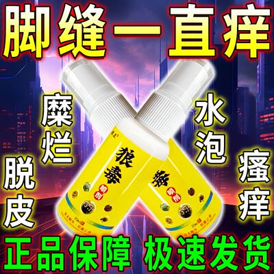 王喷雾脱皮真菌感染用臭脚痒出汗脚泡脚根趾缝糜烂痒