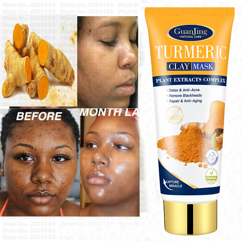 Anti Acne Tumeric Mud Mask Facial Clean Blackhead姜黄面膜泥