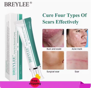 Acne Scar Removal Cream Face Repair Skin Whitening cream30g