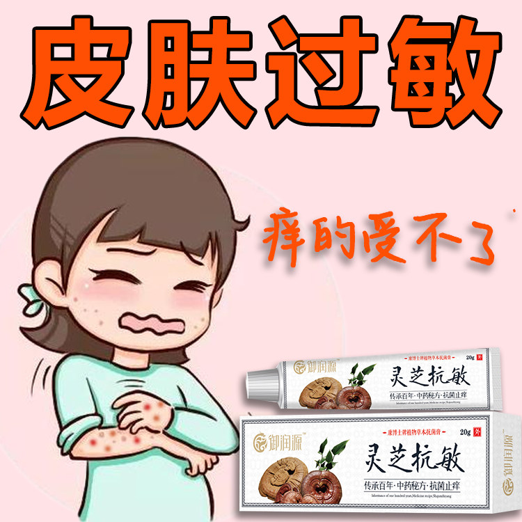接触性皮肤过敏金属过敏化学品接触皮肤红肿水泡丘疹瘙痒抗过敏膏