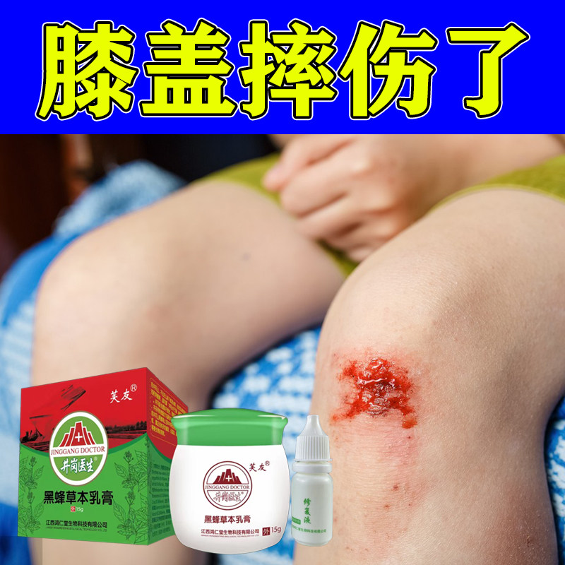 儿童摔伤破皮膝盖擦伤磕伤腿脚破皮促外伤快速结痂愈合软膏