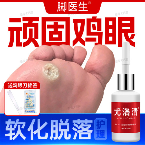 脚医生鸡眼趾疣尤洛清抑菌液
