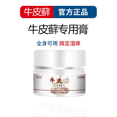 非激素的外用牛皮特效中药癣软膏专用治疗银屑病成人溼疹皮肤止痒