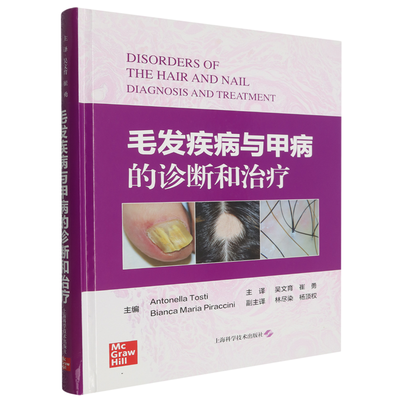 毛发疾病与甲病的诊断和治疗