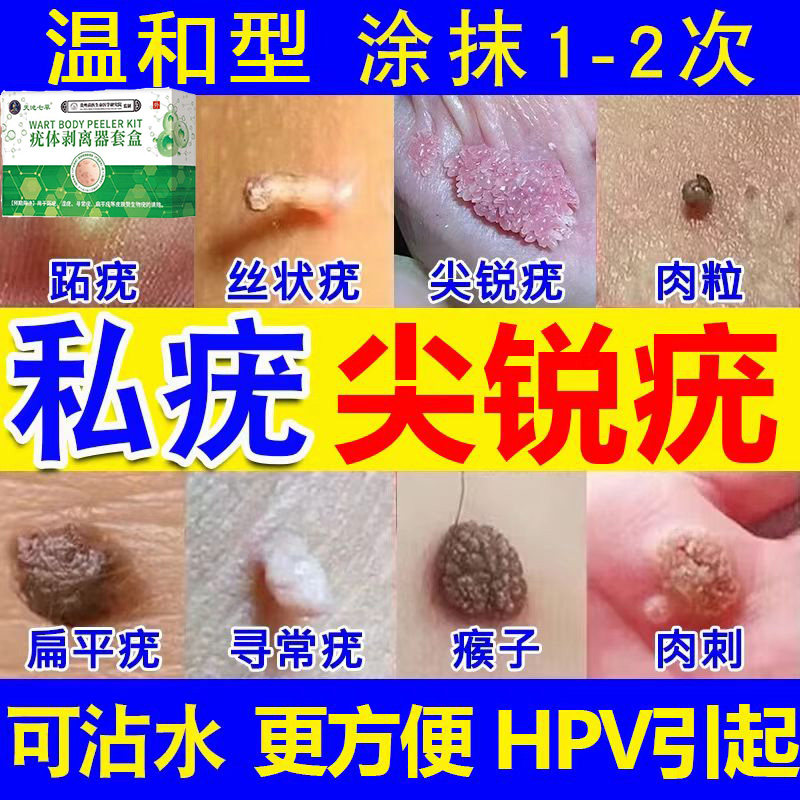 斑螯素乳软膏乳霜班螯乳膏尖锐湿疣疣体脱落斑螯素乳霜官方正品