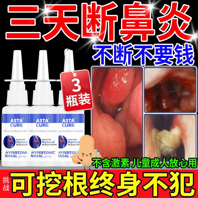 【自营】鼻炎喷雾过敏性鼻炎专用特效药膏儿童断根慢性鼻炎鼻窦炎