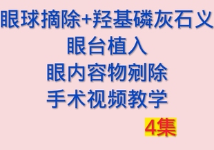 眼球摘除羟基磷灰石义眼台片植入眼内容物剜除手术视频眼科手术视