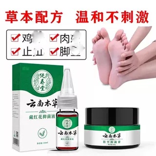 云南本草藏红花手足鸡眼茧精华液膏贴跖尤康净脚老茧脚垫肉刺瘊子