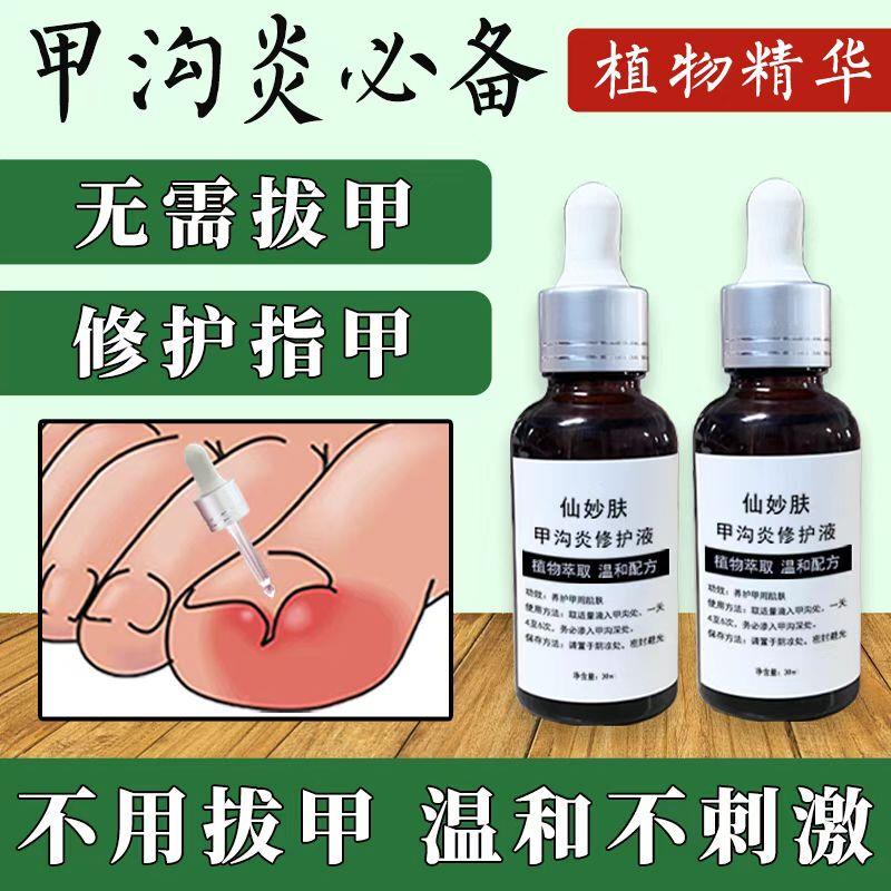 甲沟炎治疗专用药特效药膏软化剂脚趾甲往肉里长嵌甲克星息肉去除
