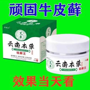 南藓本草BAT祛王抑菌乳买2膏送1 3送云2