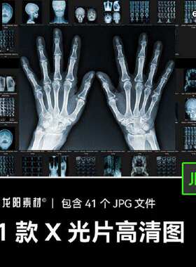 41款复古做旧噪点黑暗冷酷医学人体头骨X光片背景图片设计素材