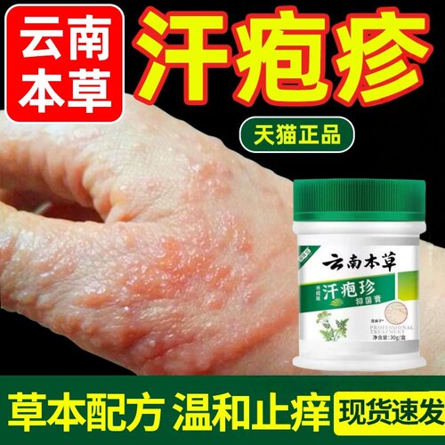 【云南本草】汗疱疹专用抑菌膏药