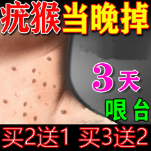 扁平疣去除软膏一抹灵去疣尤瘊用专根斩草除根祛疣小肉粒药膏医用