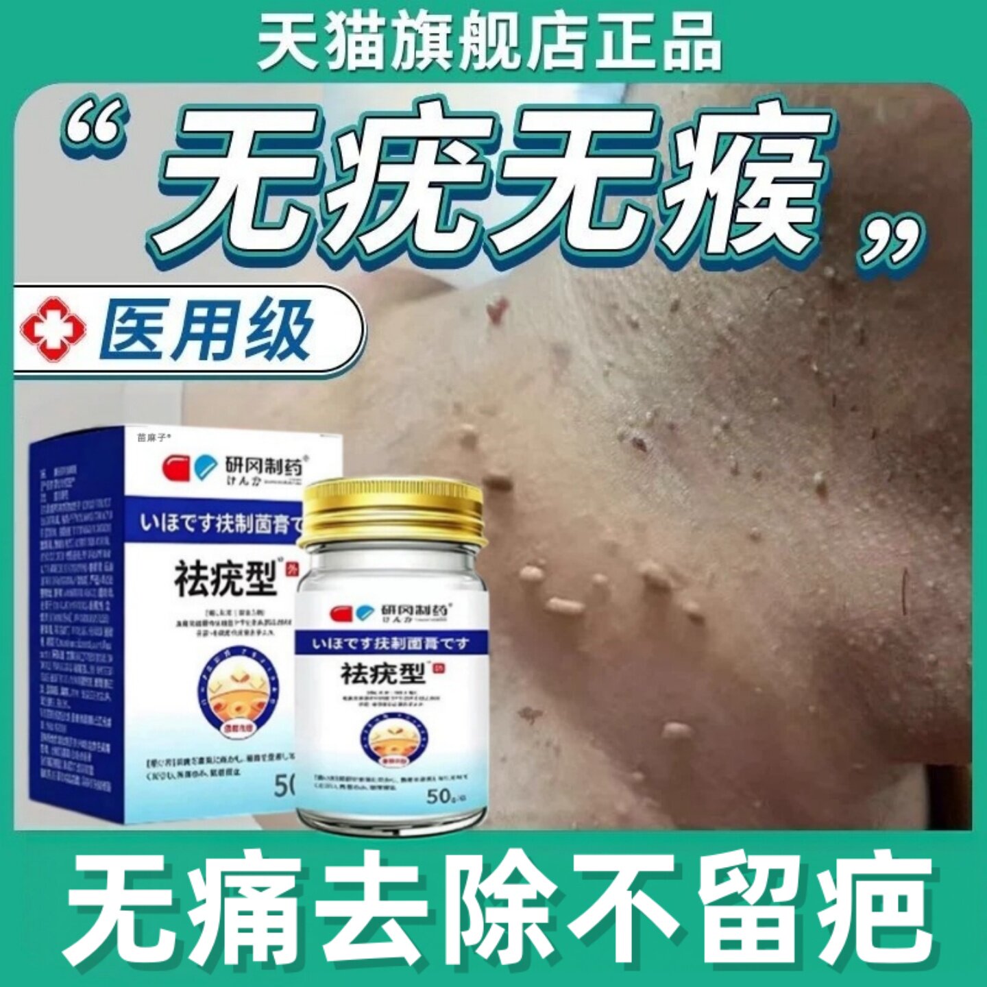 日本疣立净官方旗舰店医用级正品扁平去除膏尤猴小疙瘩脖子克尤膏