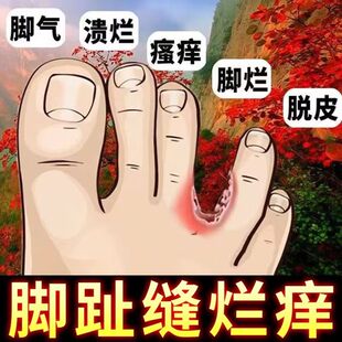 泡脚包除脚气中药包止痒脱皮杀菌烂脚丫足光粉去死皮真菌糜烂水泡