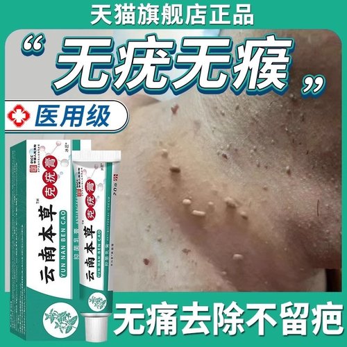 【疣瘊肉粒去除神器】草本克疣膏