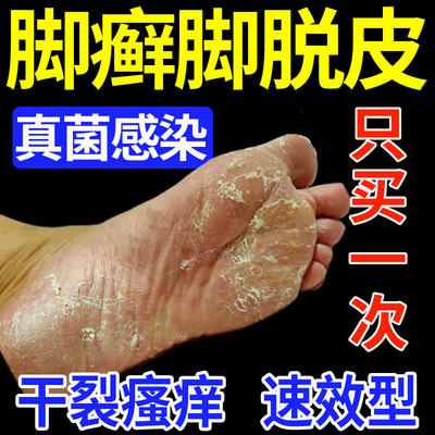 【医用级】脚臭脚癣脱皮喷雾剂