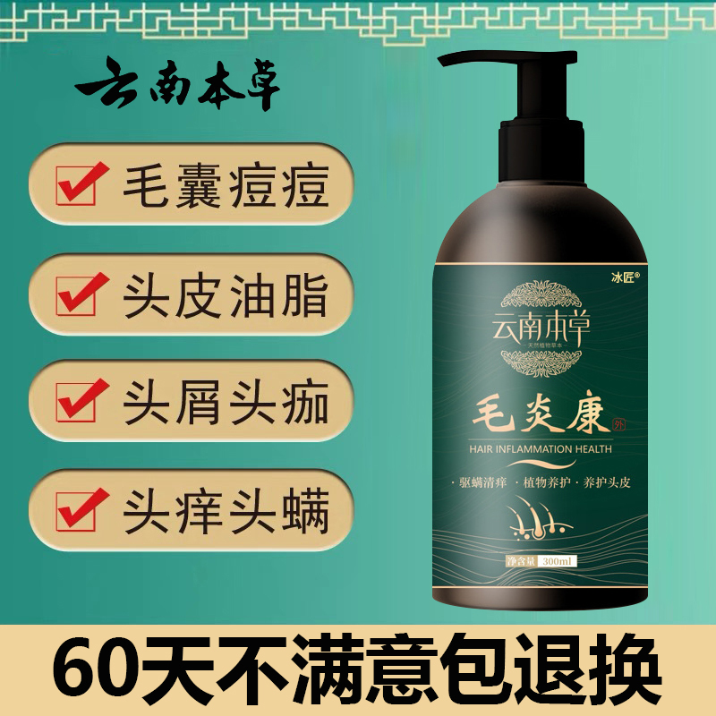毛囊炎洗发水头部专用膏毛炎宁头上长痘痘头皮毛囊炎洗发水