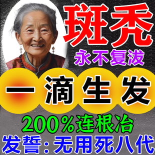 斑秃特效鬼剃头药一抹灵生发治男女专用洗发水防脱精华液遮盖神器