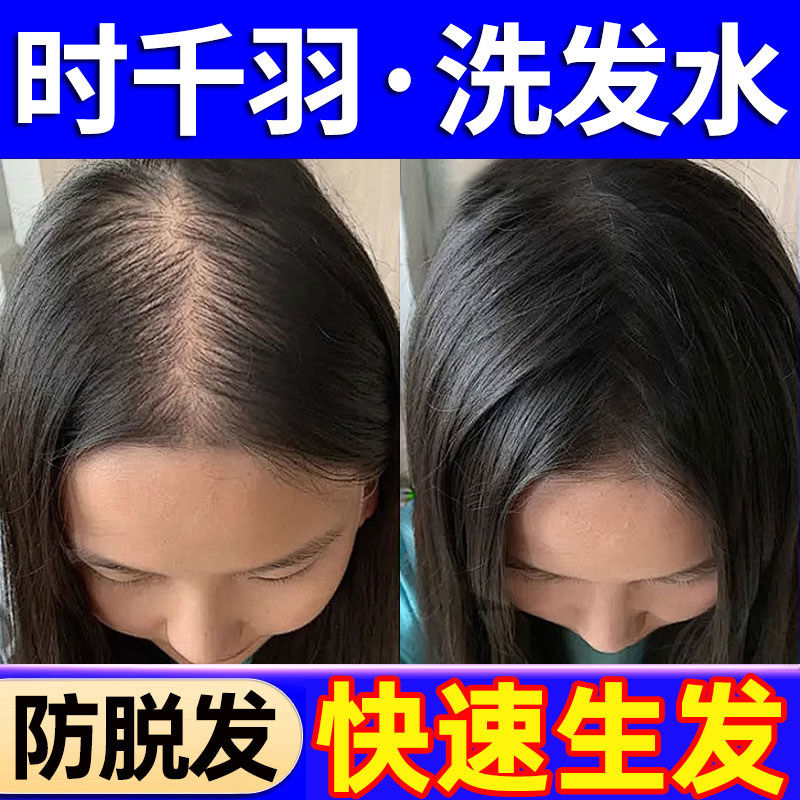 时千羽洗发水店防脱生发增密生姜去屑止痒控油蓬松胖东来正品