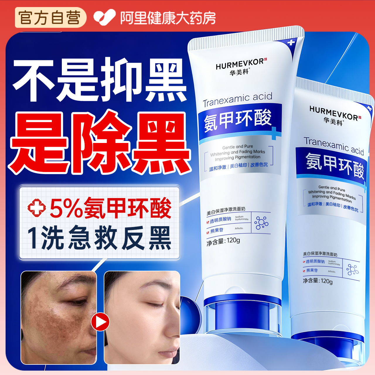 氨甲环酸氨基酸洗面奶美白淡斑提亮肤色去黄褐斑正品洁面乳男女士