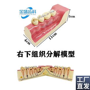 牙科口腔教学模型右下组织u分解模型龋齿解刨牙神经展示模型包邮