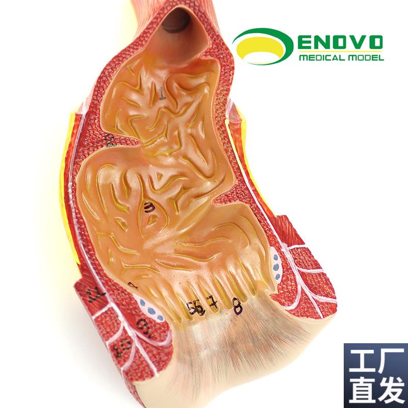 ENOVO颐诺医学人体直肠肛管肛门解剖结构模型Q肛肠科外科消化系统