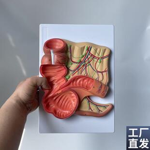 盲肠阑尾肠系膜淋巴血管回盲瓣消化道结肠直肠Q肛管肛肠医药促销