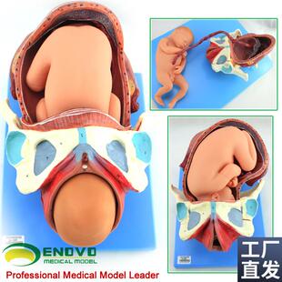 ENOVO正品妊娠胚胎q女性足月胎儿分娩产程出生胎位妇产科护理模型